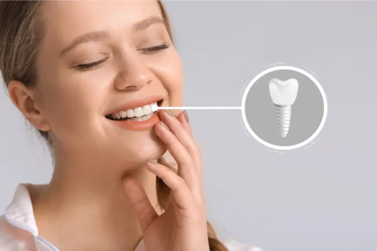 How to Make Your Dental Implants Last a Lifetime