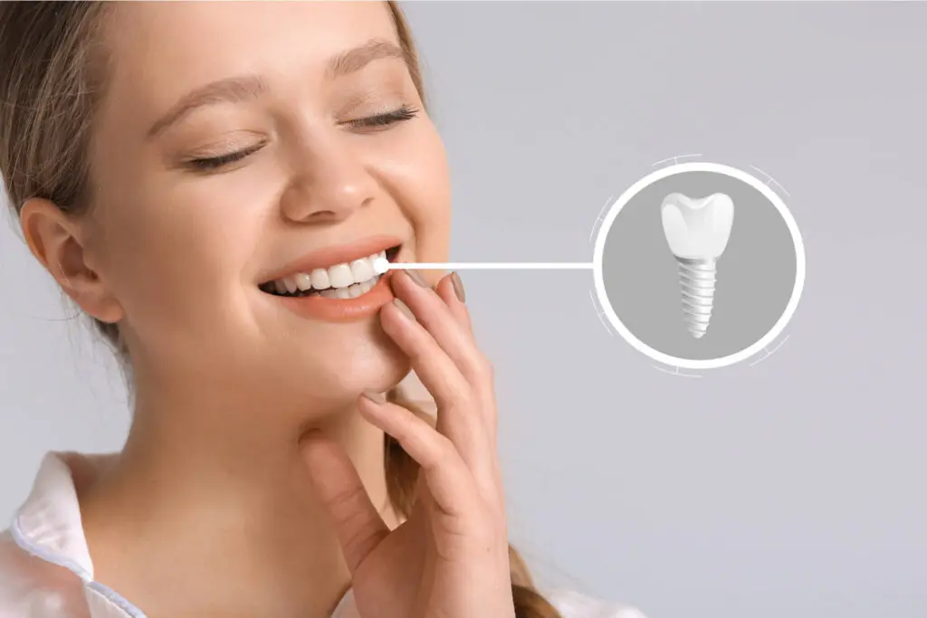How to Make Your Dental Implants Last a Lifetime