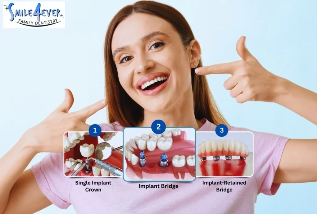 How Much Do Dental Implants Cost in Houston?